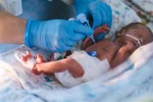 Recém nascido na UTI
